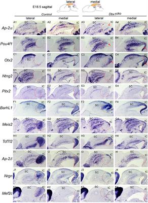 Dbx1 is a dorsal midbrain-specific determinant of GABAergic neuron fate and regulates differentiation of the dorsal midbrain into the inferior and superior colliculi